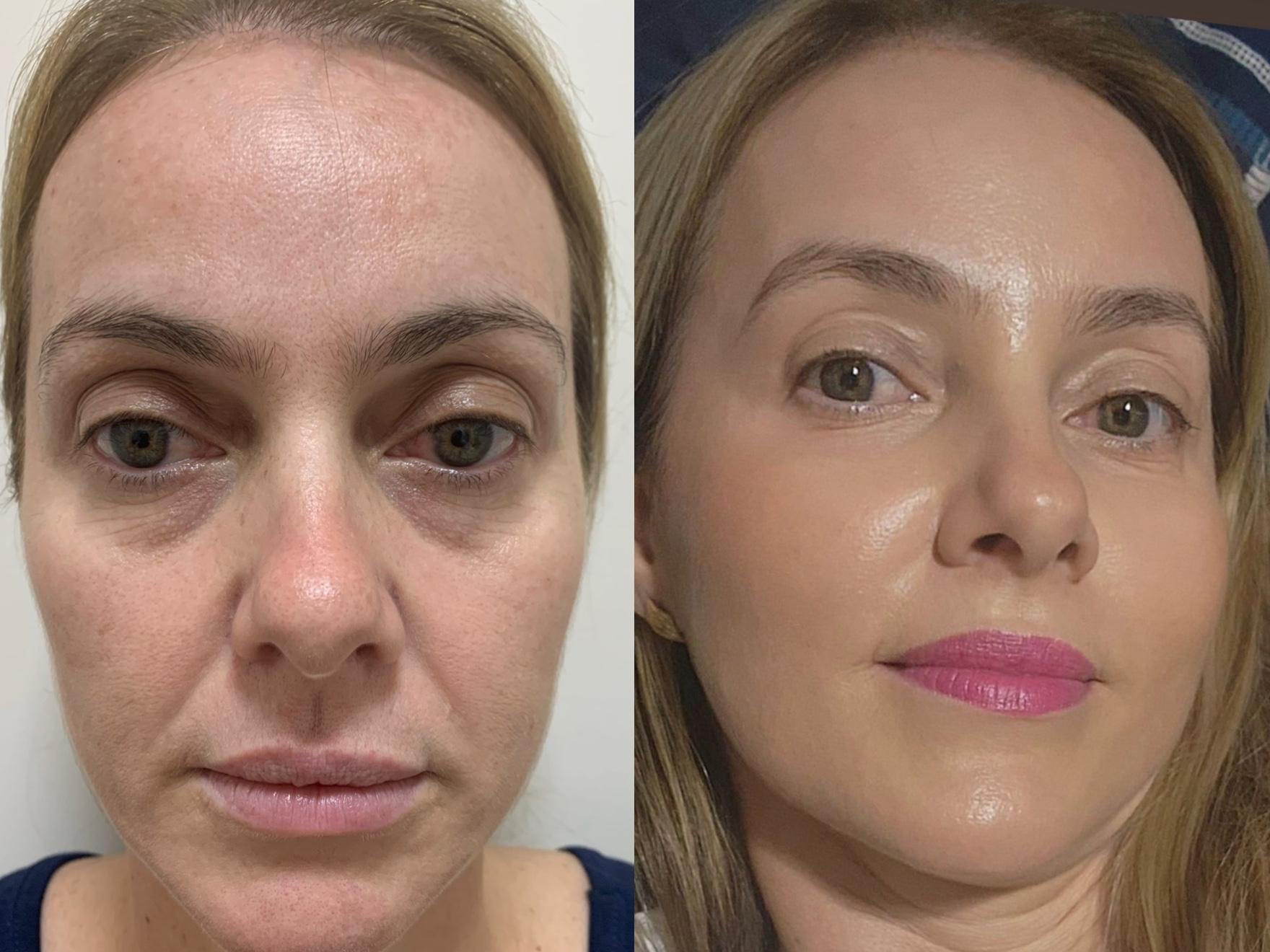 Protocolo Origin - Bioregeneracao Estetica